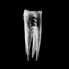 Chalk Teeth Chalk Teeth (MC)
