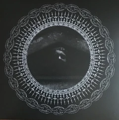 Are Mundal Nocturnal Perambulation (LP)