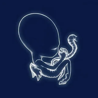Sigur Rós Ágætis Byrjun (2LP)