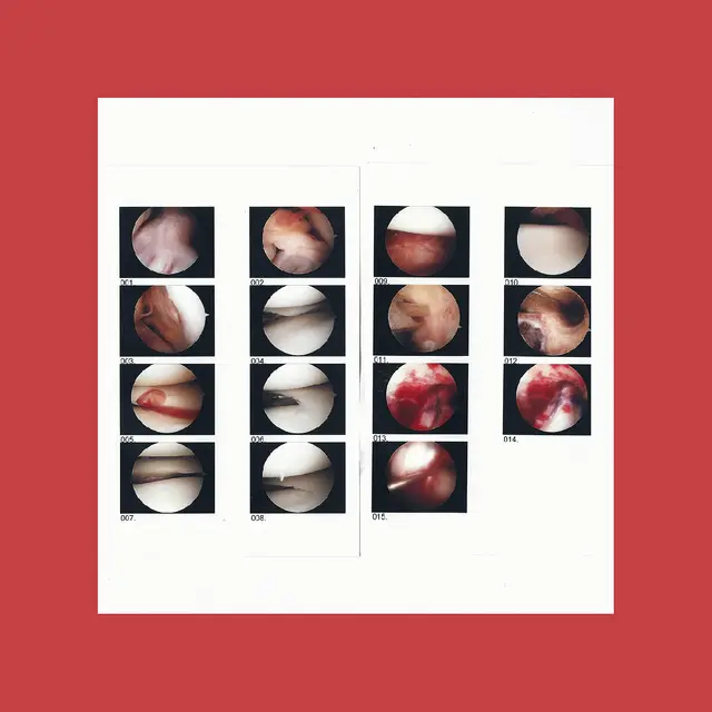The Cradle Laughing In My Sleep (LP) 