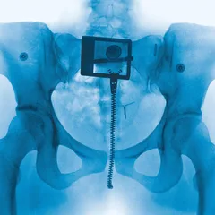 Lorde Virgin - LTD (LP)