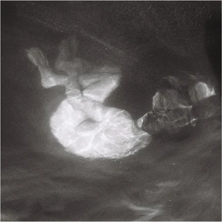 Alice Phoebe Lou Glow (LP)