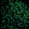 Bilayer Bilayer (CD)